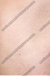 photo texture of white skin 0028